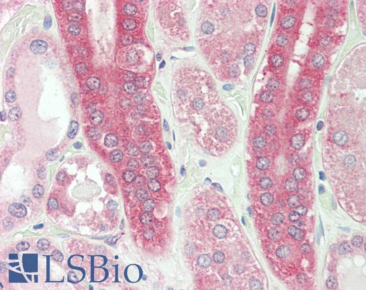 43-280 (0.01ug/ml) staining of Human (A) , Mouse (B) and Rat (C) Heart lysates (35ug protein in RIPA buffer) . Primary incubation was 1 hour. Detected by chemiluminescence.