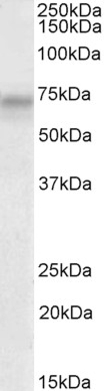 43-288 (0.03ug/ml) staining of Human (A) , Mouse (B) and Rat (C) Skeletal Muscle lysate (35ug protein in RIPA buffer) . Primary incubation was 1 hour. Detected by chemiluminescence.