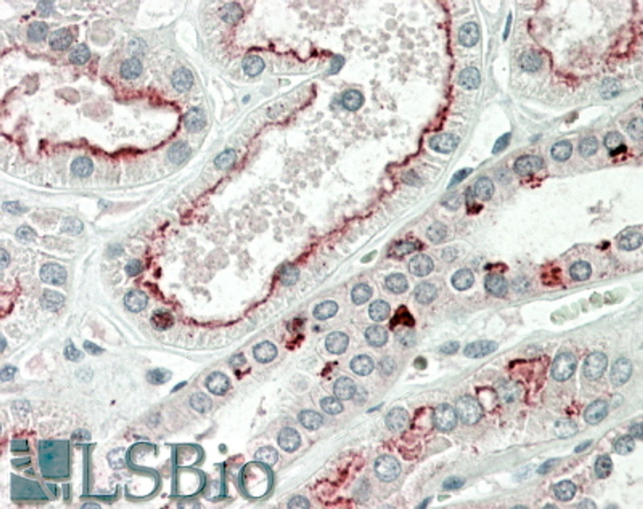 43-291 (0.03ug/ml) staining of Human Skeletal Muscle lysate (35ug protein in RIPA buffer) . Primary incubation was 1 hour. Detected by chemiluminescence.