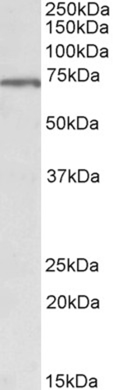 43-294 (0.01ug/ml) staining of Human (A) , Mouse (B) and Rat (C) Skeletal Muscle lysates (35ug protein in RIPA buffer) . Primary incubation was 1 hour. Detected by chemiluminescence.