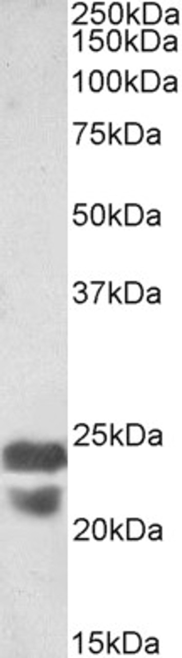 43-302 (0.01ug/ml) staining of Human Peripheral Lymphocytes lysate (35ug protein in RIPA buffer) . Primary incubation was 1 hour. Detected by chemiluminescence.