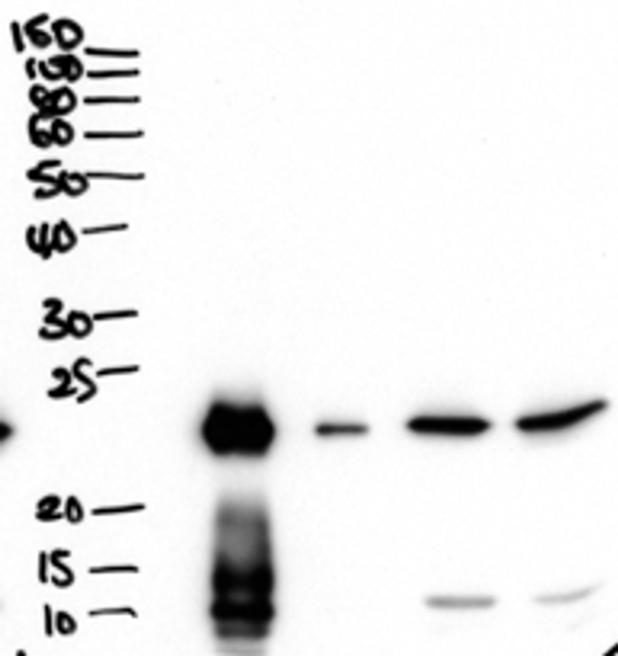 43-306 (1ug/ml) staining of Mouse Liver lysate (35ug protein in RIPA buffer) . Detected by chemiluminescence.