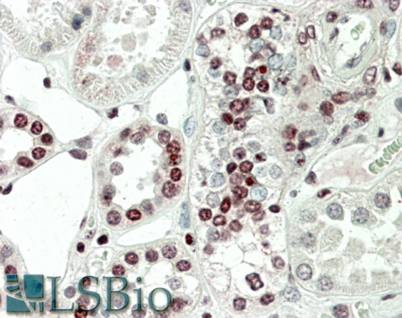 HEK293 lysate (10ug protein in RIPA buffer) overexpressing Mouse MK5-GFP (first lane) or Mouse MK2-GFP (second lane) probed with 43-311 (0.5ug/ml) in right panel and with EB11928 (0.5ug/ml) on left panel, Primary incubations were for 2 hours. Detected by