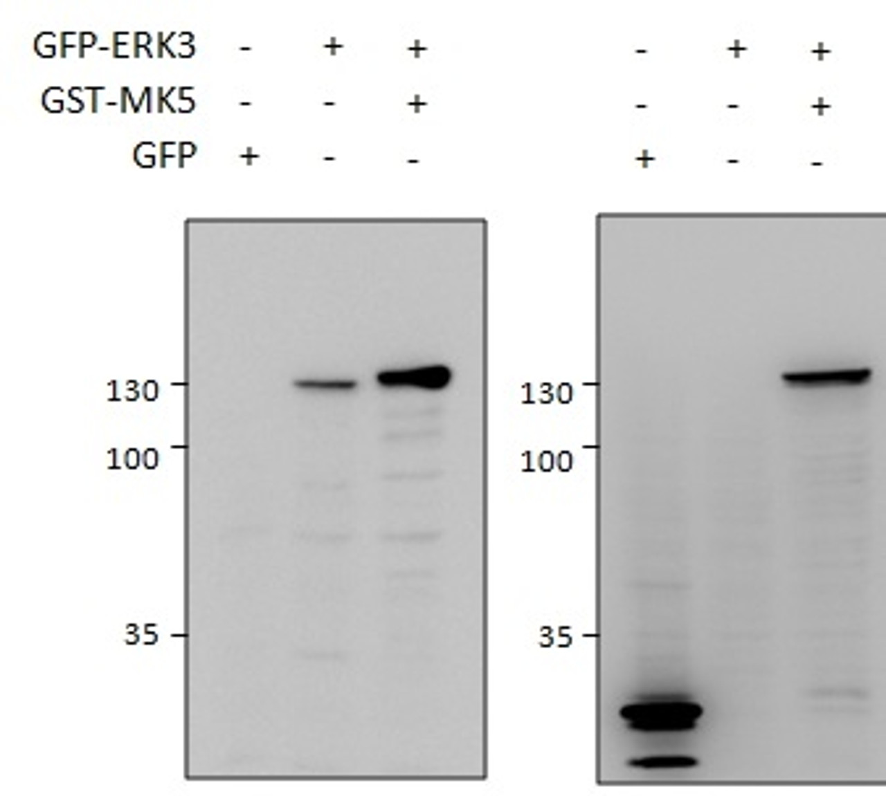 43-311 and EB11928 (1.5ug) immunoprecipitations from lysates of MK5/ERK3 double knockout MEFs, with (third and fifth lanes) and without (fourth and sixth lanes) rescued MK5/ERK3 expression through retroviral transduction. The corresponding lysates (first