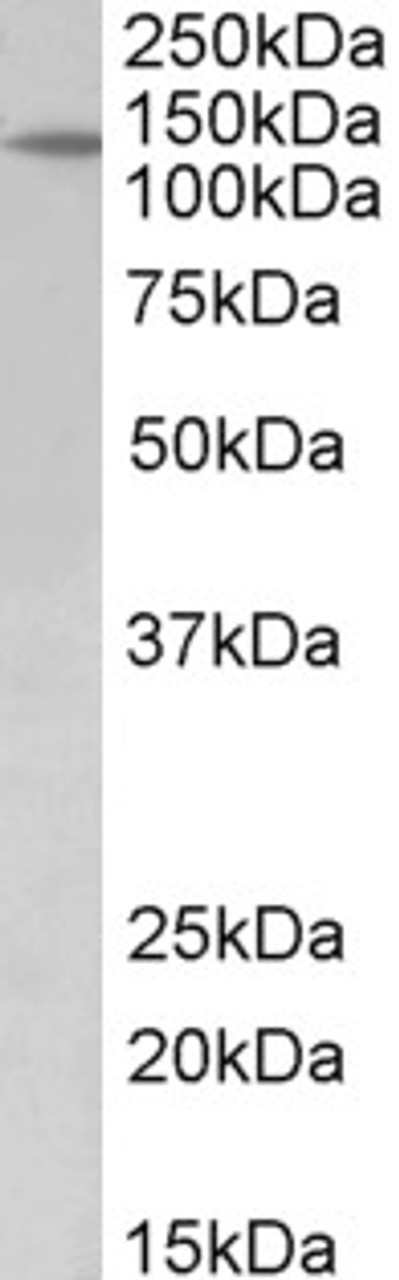 HEK293 overexpressing Mouse MK2 fused to GFP or overexpressing MK5 fused to GFP and probed with 43-313 (0.5ug/ml) in the left panel and with EB11930 (0.5ug/ml) in the right panel.