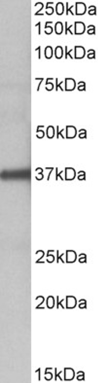 HEK293 overexpressing Human CCDC3 with C-terminal tag (DYKDDDDK) and probed with anti-DYKDDDDK in the left panel and with 43-330 (0.5ug/ml) in the right panel (empty vector transfection in first lanes) . Data obtained from Dr. YangXin Fu, Dept Oncology, U