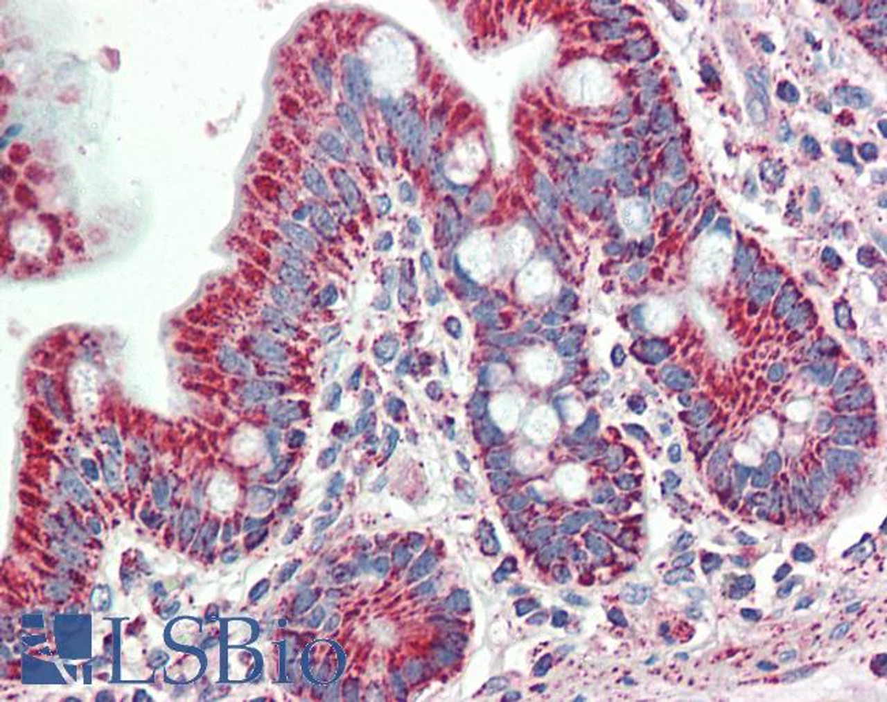 43-334 (1ug/ml) staining of Human Colorectal cancer lysate (35ug protein in RIPA buffer) . Primary incubation was 1 hour. Detected by chemiluminescence.