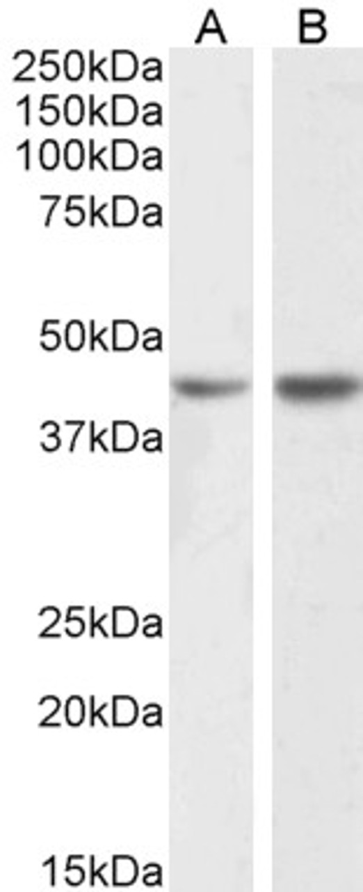 43-338 (5ug/ml) staining of paraffin embedded Human Placenta. Steamed antigen retrieval with citrate buffer pH 6, AP-staining.