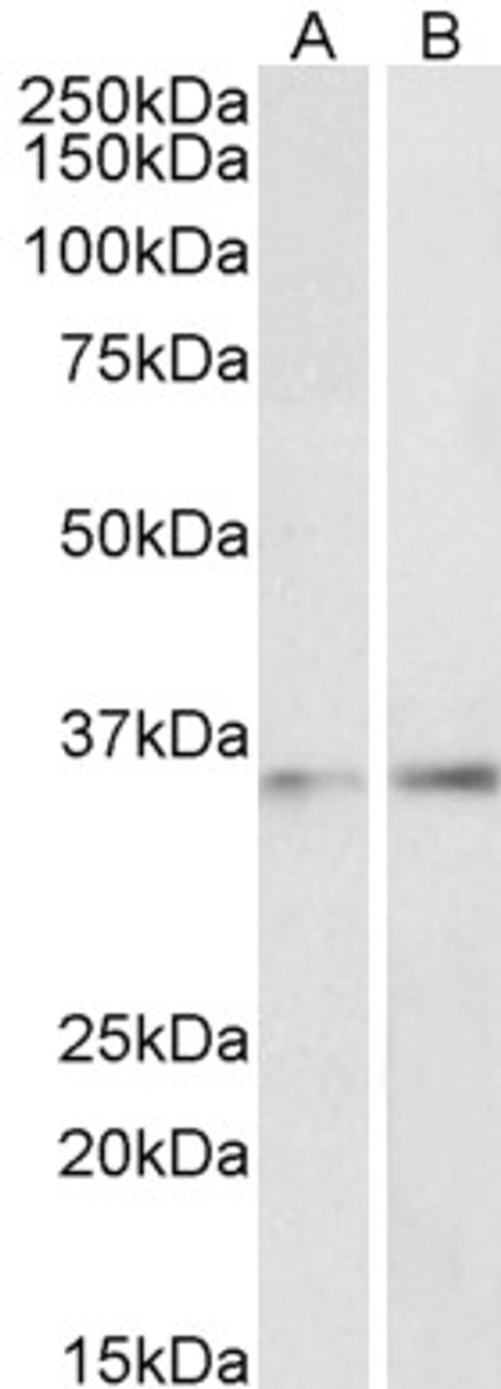 43-341 (0.5ug/ml) staining of Mouse Duodenum lysate (35ug protein in RIPA buffer) . Primary incubation was 1 hour. Detected by chemiluminescence.