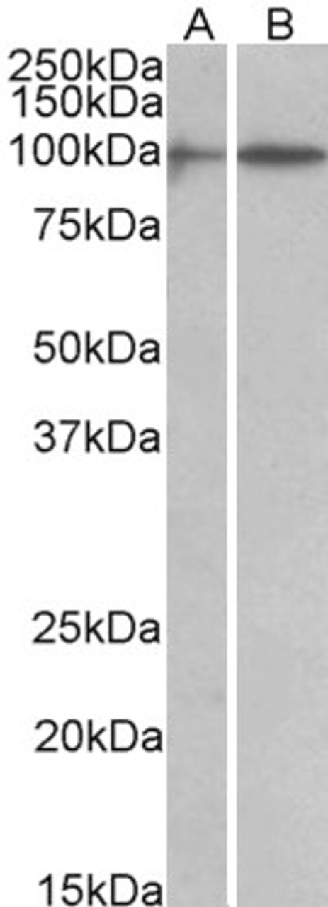 43-361 (1ug/ml) staining of Human Lung lysate (35ug protein in RIPA buffer) . Primary incubation was 1 hour. Detected by chemiluminescence.