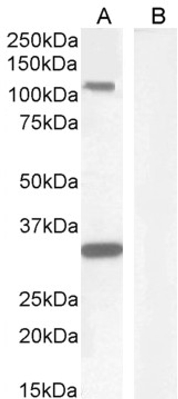 43-364 (0.03ug/ml) staining of Mouse (A) and Rat (B) Skeletal Muscle lysate (35ug protein in RIPA buffer) . Primary incubation was 1 hour. Detected by chemiluminescence.