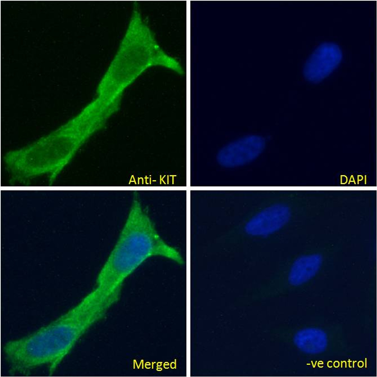 43-371 (5ug/ml) staining of paraffin embedded Human Retina. Steamed antigen retrieval with citrate buffer pH 6, AP-staining.