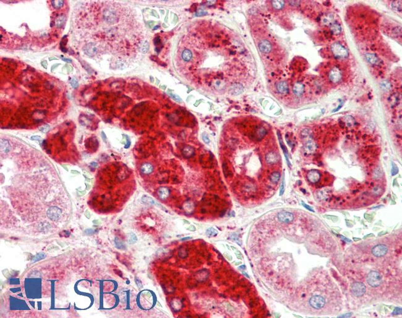 43-375 (1ug/ml) staining of MCF7 (A) and Human Breast cancer (B) lysates (35ug protein in RIPA buffer) . Primary incubation was 1 hour. Detected by chemiluminescence.