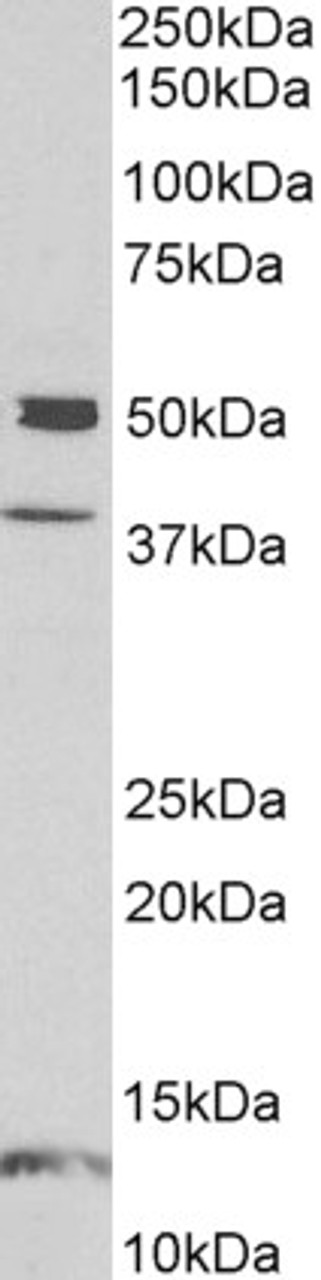 43-376 (1ug/ml) staining of HeLa lysate (35ug protein in RIPA buffer) . Primary incubation was 1 hour. Detected by chemiluminescence.