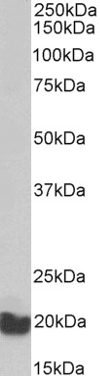 43-378 (2ug/ml) staining of MCF7 lysate (35ug protein in RIPA buffer) . Primary incubation was 1 hour. Detected by chemiluminescence.