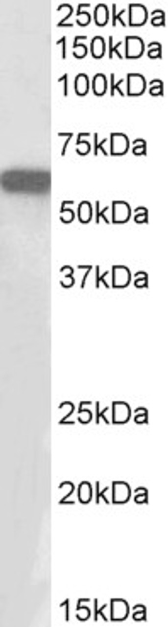 43-382 (1ug/ml) staining of Human Skeletal Muscle lysate (35ug protein in RIPA buffer) . Primary incubation was 1 hour. Detected by chemiluminescence.