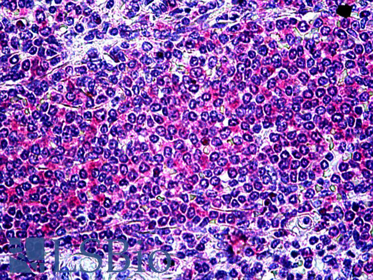 43-393 (1ug/ml) staining of Human Frontal Cortex lysate (35ug protein in RIPA buffer) . Detected by chemiluminescence.