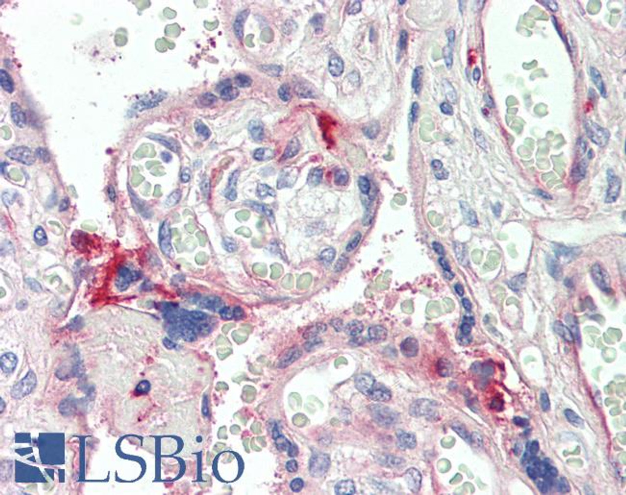 43-396 (1ug/ml) staining of Pig Kidney lysate (35ug protein in RIPA buffer) . Primary incubation was 1 hour. Detected by chemiluminescence.