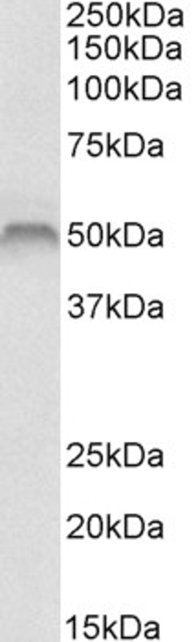 43-398 (0.2ug/ml) staining of Human Skeletal Muscle lysate (35ug protein in RIPA buffer) . Detected by chemiluminescence.