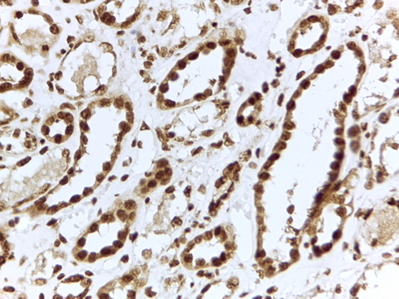 43-430 (0.1ug/ml) staining of Human Pancreas lysate (35ug protein in RIPA buffer) . Detected by chemiluminescence.