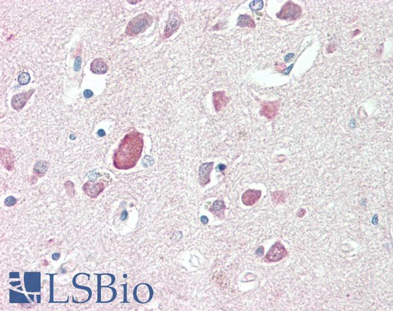 43-439 (1ug/ml) staining of Rat (A) and (0.1ug/ml) Pig (B) Brain lysate (35ug protein in RIPA buffer) . Detected by chemiluminescence.