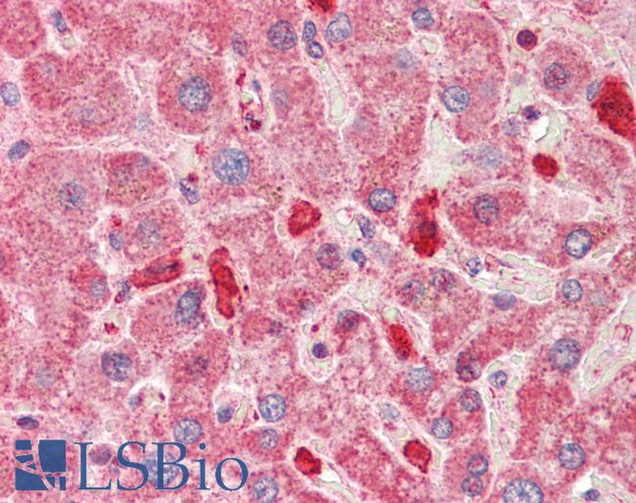 43-441 (0.3ug/ml) staining of Human Cerebellum (A) , Mouse Brain (B) and Rat Brain (C) lysates (35ug protein in RIPA buffer) . Detected by chemiluminescence.