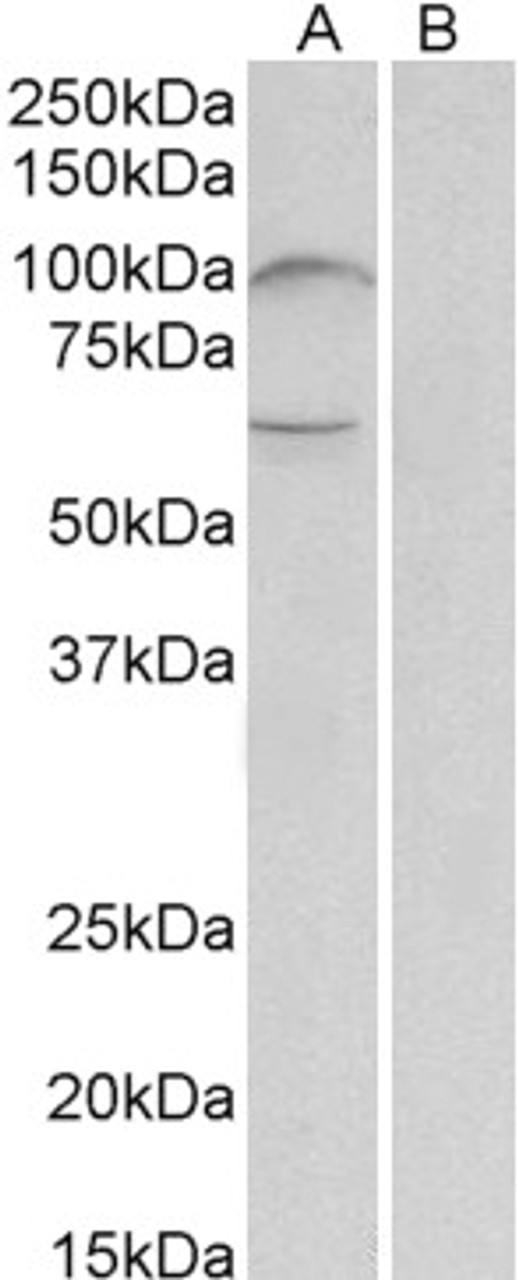 43-444 (1ug/ml) staining of Human Erythrocytes lysate (35ug protein in RIPA buffer) . Primary incubation was 1 hour. Detected by chemiluminescence.