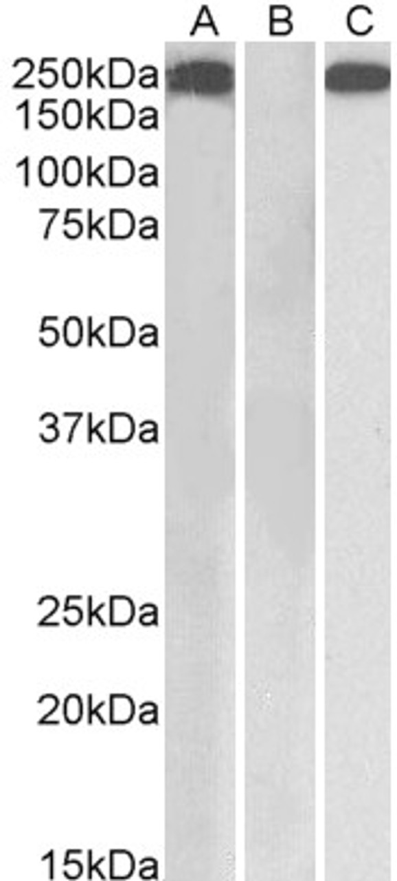 43-462 (0.3ug/ml) staining of Human Kidney (A) and Liver (B) lysates (35ug protein in RIPA buffer) . Detected by chemiluminescence.