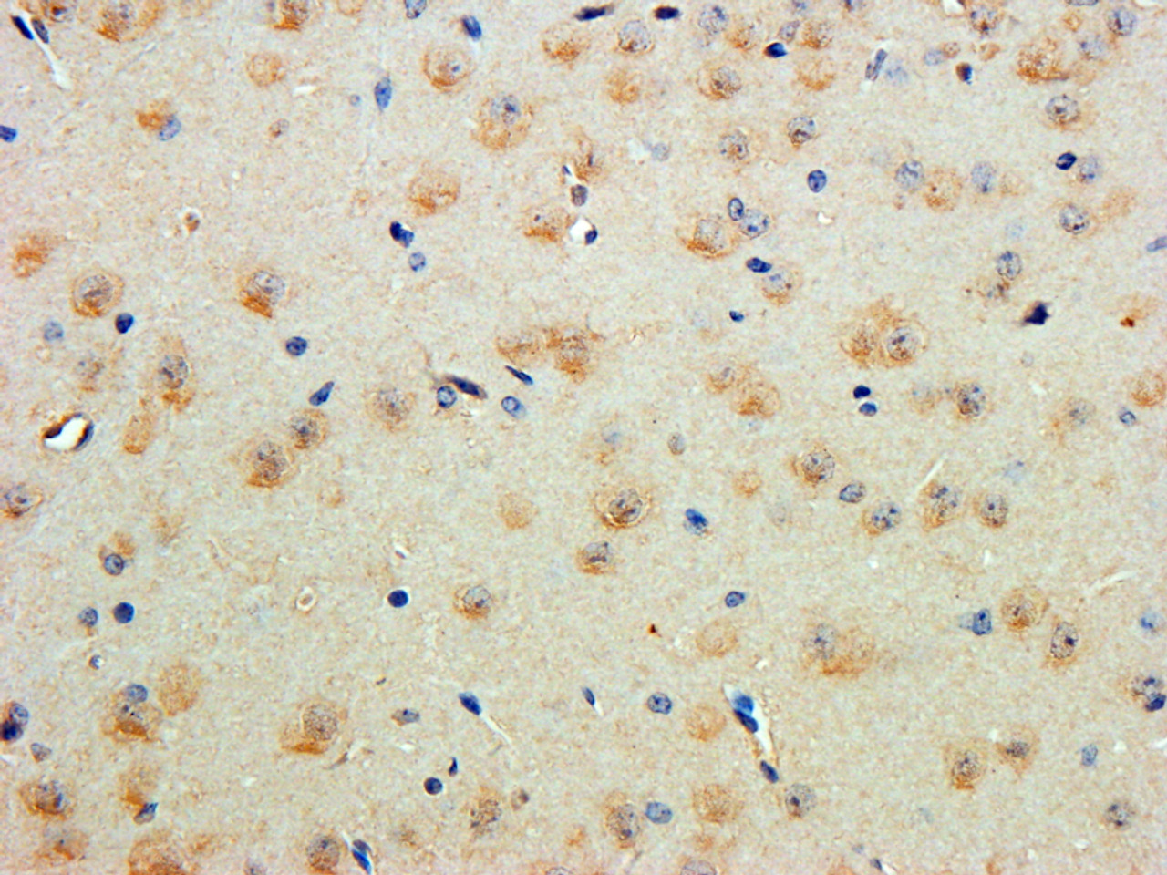 43-468 (2ug/ml) staining of Human Bone Marrow lysate (35ug protein in RIPA buffer) with (B) and without (A) blocking with the immunizing peptide. Primary incubation was 1 hour. Detected by chemiluminescence.