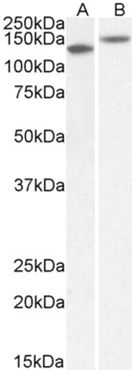 43-476 (0.03ug/ml) staining of Albumin-depleted Plasma lysate (35ug protein in RIPA buffer) . Primary incubation was 1 hour. Detected by chemiluminescence.