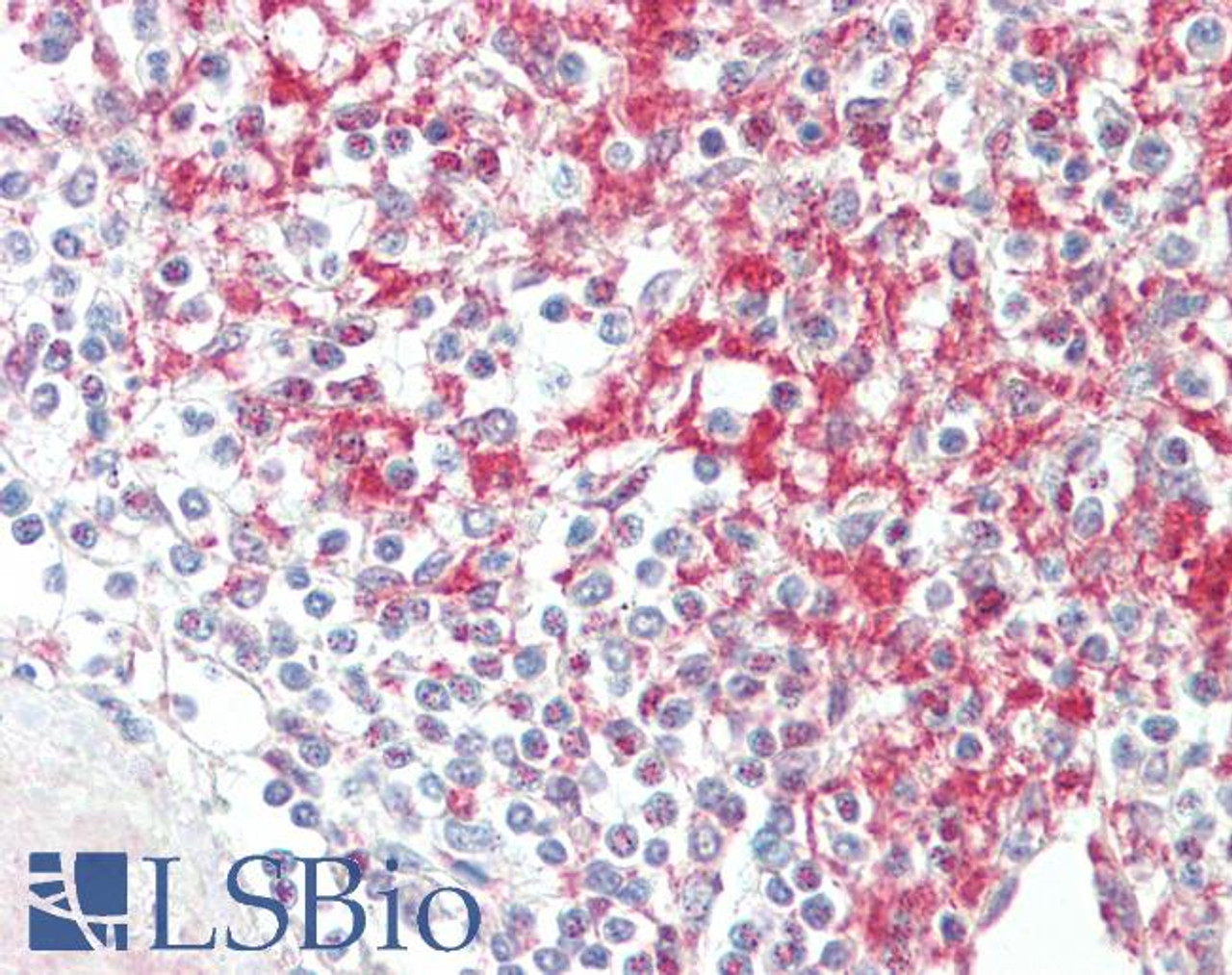 43-489 (0.1ug/ml) staining of HeLa lysate (35ug protein in RIPA buffer) . Primary incubation was 1 hour. Detected by chemiluminescence.