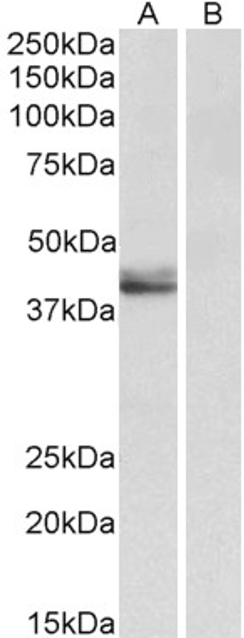 43-514 (0.01ug/ml) staining of Human (A) , fetal Mouse (B) , adult Mouse (C) and adult Rat (D) Heart lysates (35ug protein in RIPA buffer) . Primary incubation was 1 hour. Detected by chemiluminescence.