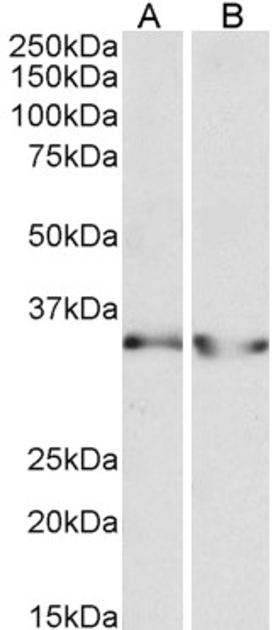 43-515 (0.3ug/ml) staining of Heart (A) , Skeletal Muscle (B) and Kidney (C) lysates (35ug protein in RIPA buffer) . Primary incubation was 1 hour. Detected by chemiluminescence.