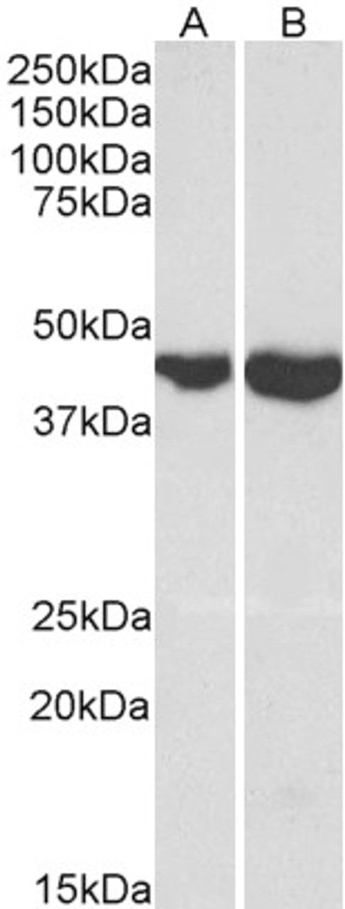 43-521 (0.3ug/ml) staining of U937 (A) and Human Spleen (B) lysates (35ug protein in RIPA buffer) . Primary incubation was 1 hour. Detected by chemiluminescence.