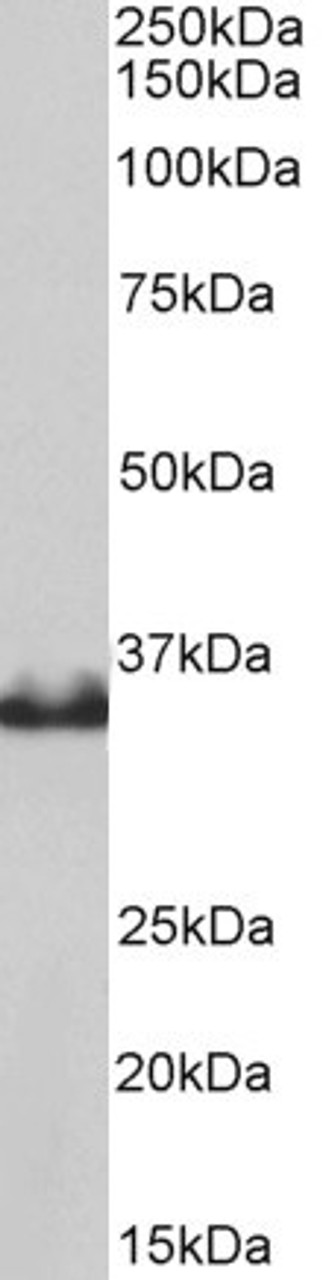 43-522 (0.3ug/ml) staining of U937 (A) and Human Spleen (B) lysates (35ug protein in RIPA buffer) . Primary incubation was 1 hour. Detected by chemiluminescence.
