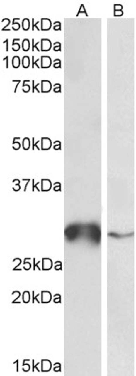 43-546 (0.1ug/ml) staining of Human (A) , Mouse (B) and Rat (C) Heart lysates (35ug protein in RIPA buffer) . Primary incubation was 1 hour. Detected by chemiluminescence.