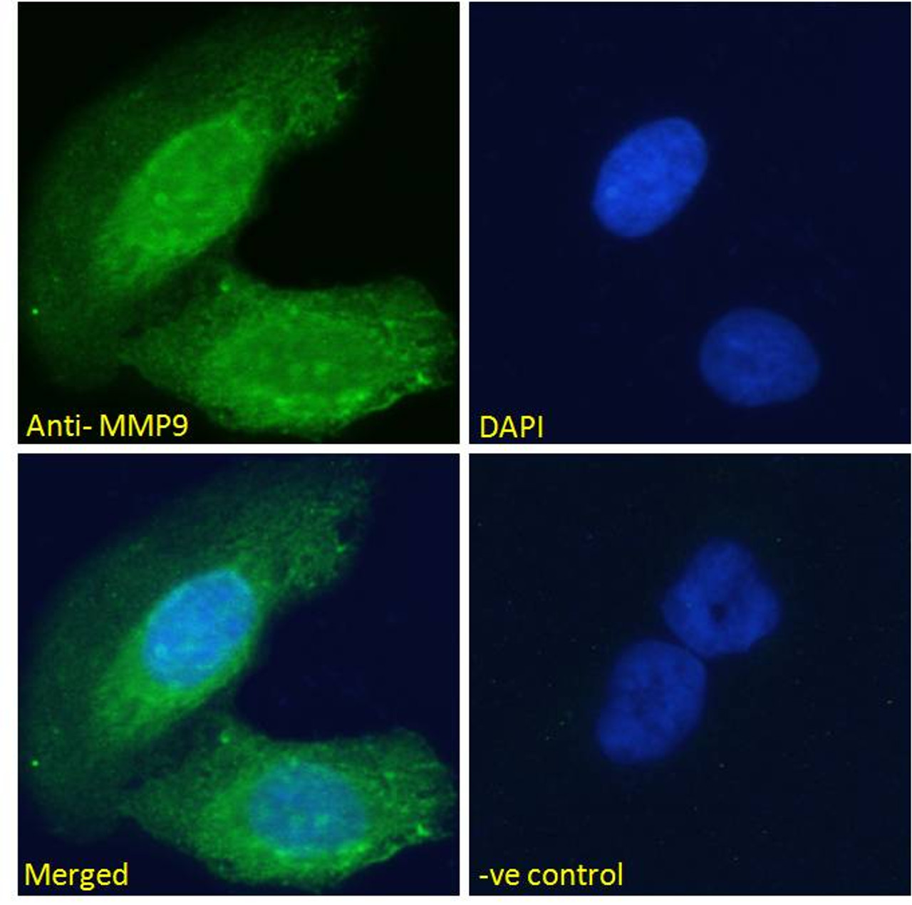 43-566 (0.1ug/ml) staining of CACO-2 lysate (35ug protein in RIPA buffer) . Primary incubation was 1 hour. Detected by chemiluminescence.