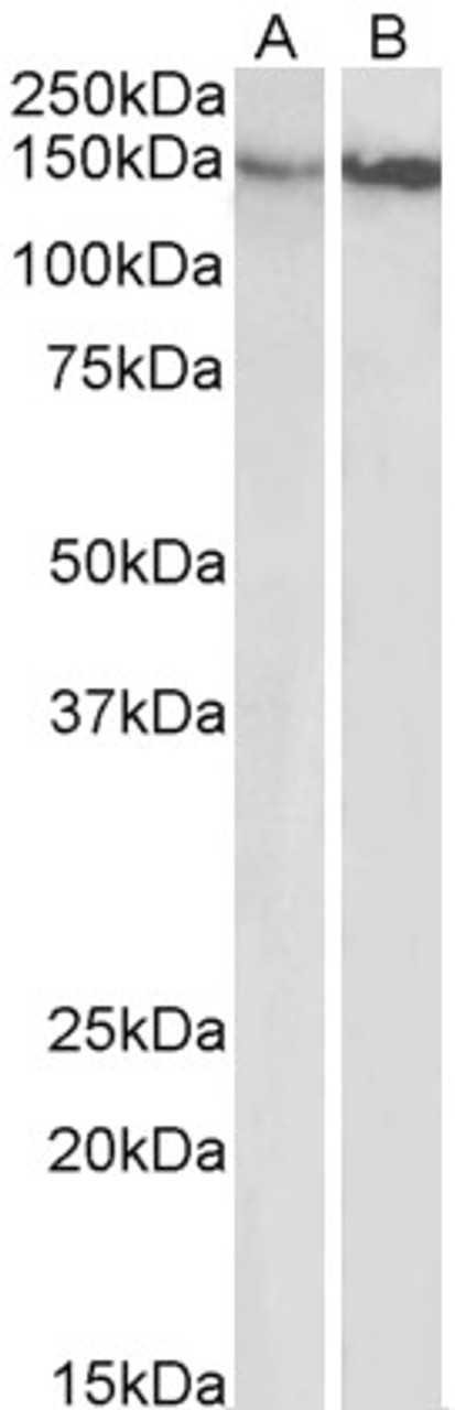 43-567 (0.1ug/ml) staining of K562 nuclear lysate (35ug protein in RIPA buffer) . Primary incubation was 1 hour. Detected by chemiluminescence.