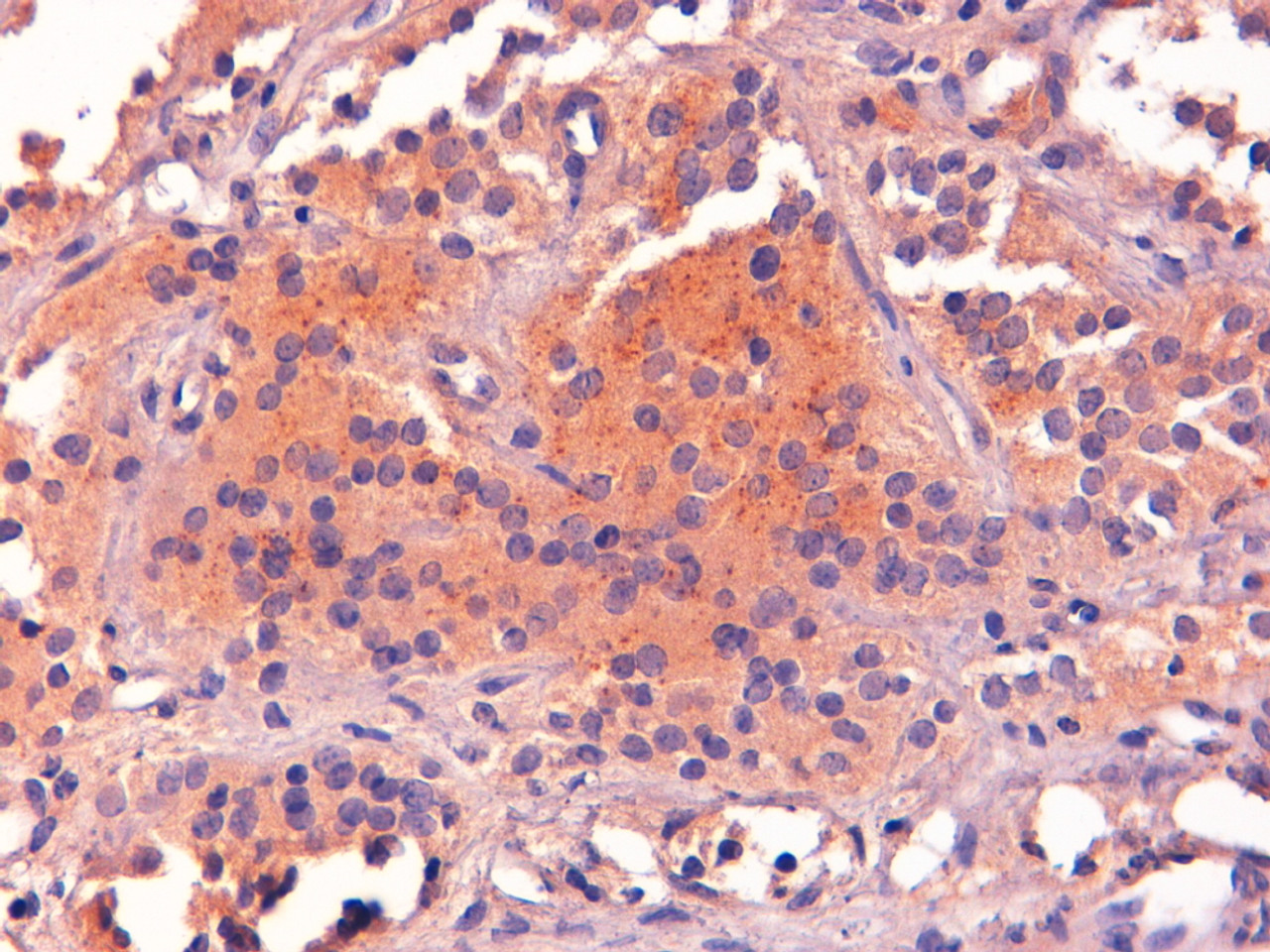 46-208 (0.3µg/ml) staining of NIH3T3 cell lysate (A) and (2ug/ml) Rat Brain (B) lysate (35µg protein in RIPA buffer) . Detected by chemiluminescence.