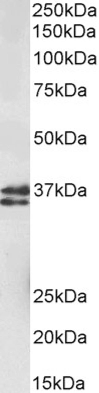 43-601 (1ug/ml) staining of Mouse (A) and Rat (B) Spleen lysates (35ug protein in RIPA buffer) . Primary incubation was 1 hour. Detected by chemiluminescence.