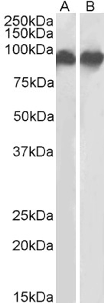 43-609 (1ug/ml) staining of fetal Mouse Brain lysate (35ug protein in RIPA buffer) . Detected by chemiluminescence.