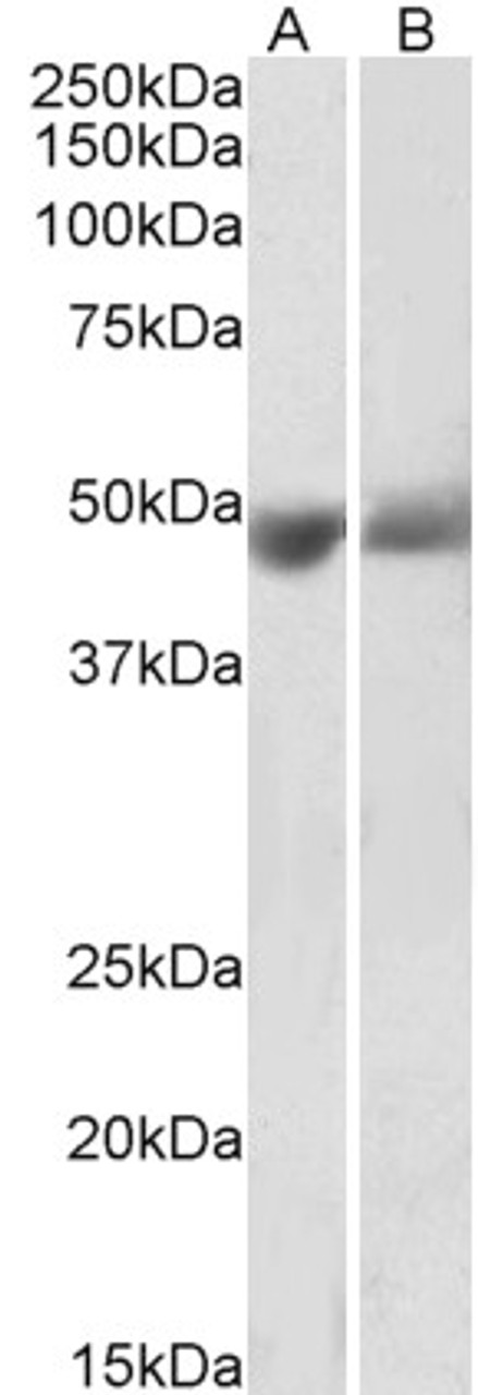 43-610 (1ug/ml) staining of Human Peripheral Blood Lymphocytes lysate (35ug protein in RIPA buffer) . Primary incubation was 1 hour. Detected by chemiluminescence.