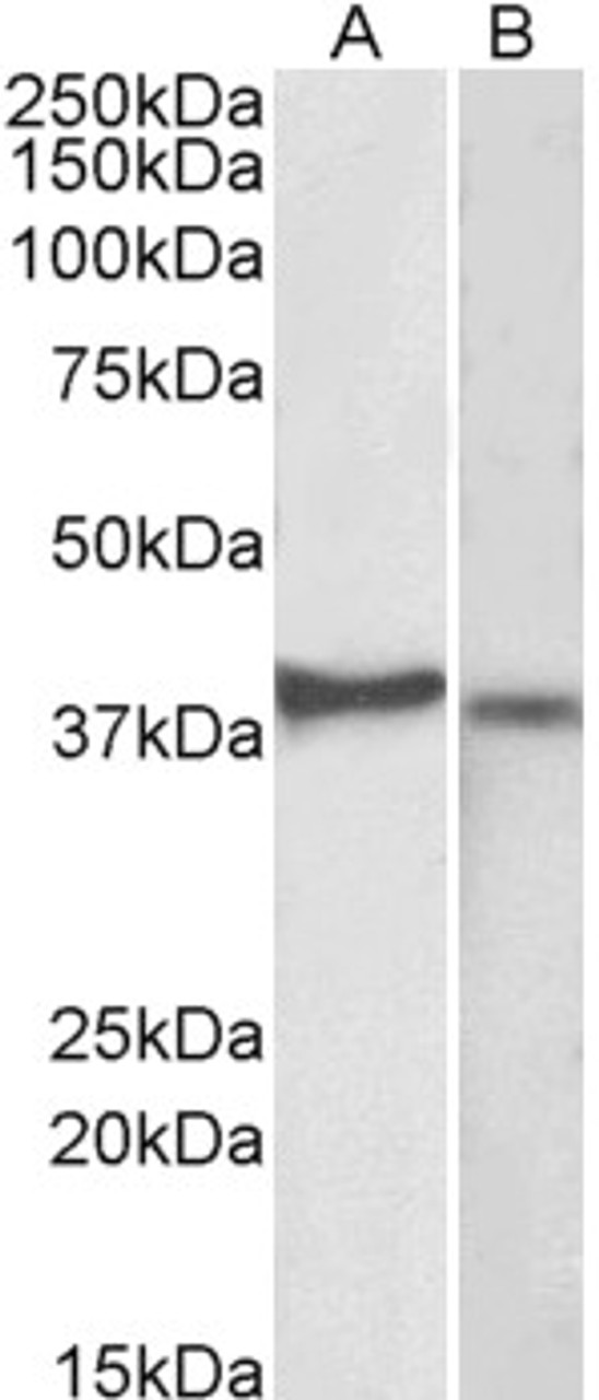 43-626 (0.01ug/ml) staining of A549 (A) and HeLa (B) lysates (35ug protein in RIPA buffer) . Primary incubation was 1 hour. Detected by chemiluminescence.