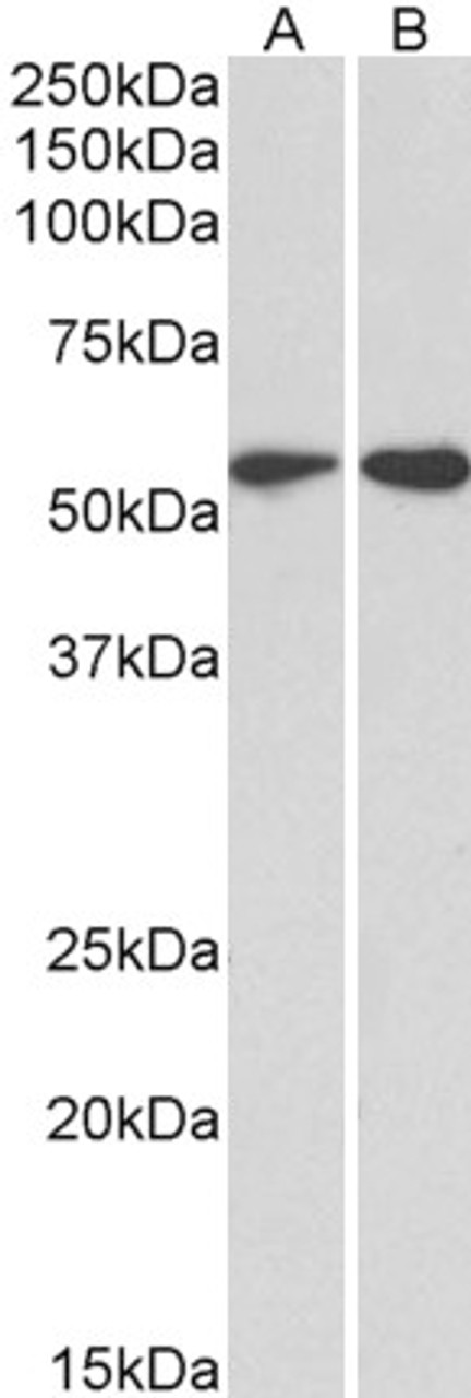 43-634 (0.1ug/ml) staining of Jurkat (A) and (0.3ug/ml) MOLT4 (B) cell lysate (35ug protein in RIPA buffer) . Primary incubation was 1 hour. Detected by chemiluminescence.