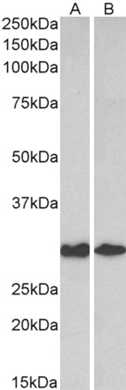 43-640 (0.3ug/ml) staining of HeLa lysate (35ug protein in RIPA buffer) . Primary incubation was 1 hour. Detected by chemiluminescence.