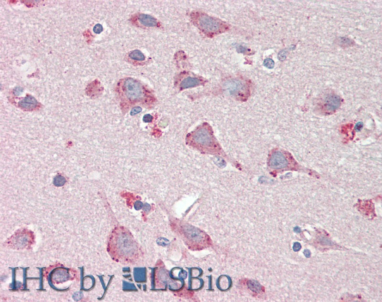 43-649 (0.1ug/ml) staining of Mouse (A) and (2ug/ml) Rat (B) Ovary lysate (35ug protein in RIPA buffer) . Primary incubation was 1 hour. Detected by chemiluminescence.