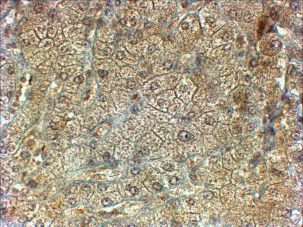 43-665 (2ug/ml) staining of Jurkat (A) and Molt4 (B) lysates (35ug protein in RIPA buffer) . Detected by chemiluminescence.