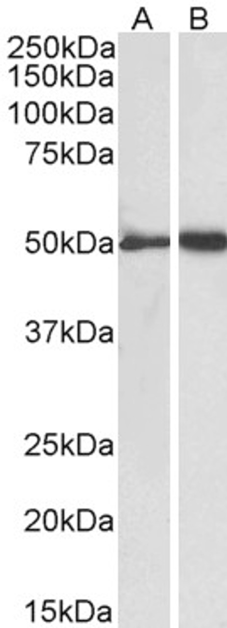 43-666 (0.1ug/ml) staining of Placenta lysate (35ug protein in RIPA buffer) . Detected by chemiluminescence.