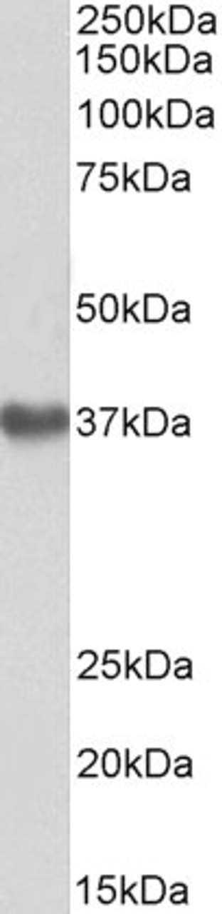 43-681 (0.01ug/ml) staining of Human Platelets lysate (35ug protein in RIPA buffer) . Primary incubation was 1 hour. Detected by chemiluminescence.