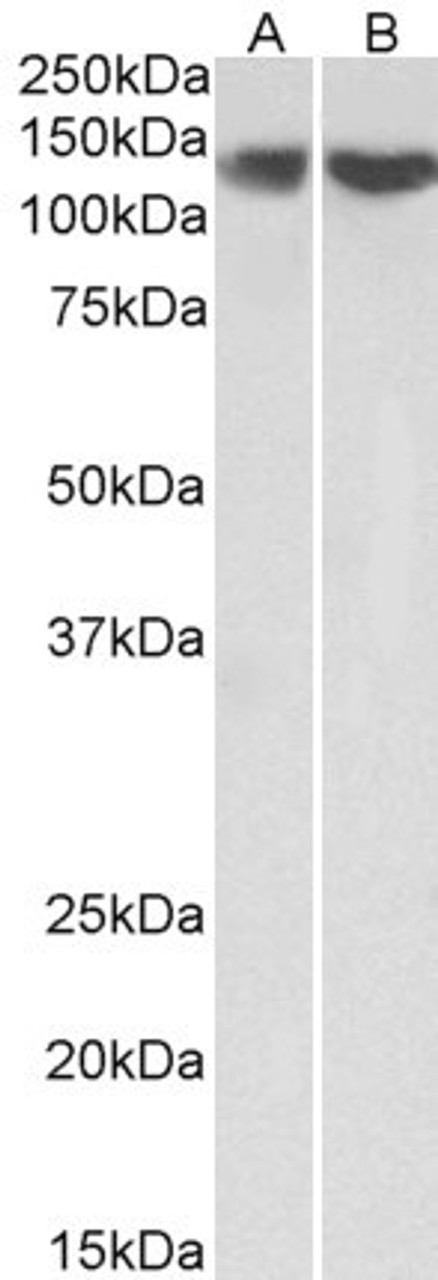 43-689 (0.3ug/ml) staining of Human Lymph Node lysate (35ug protein in RIPA buffer) . Primary incubation was 1 hour. Detected by chemiluminescence.